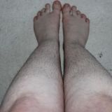 This is what my legs look like after VGmedispa laser hair removal. I´d say I have even more hair than before. Will be posting more pics